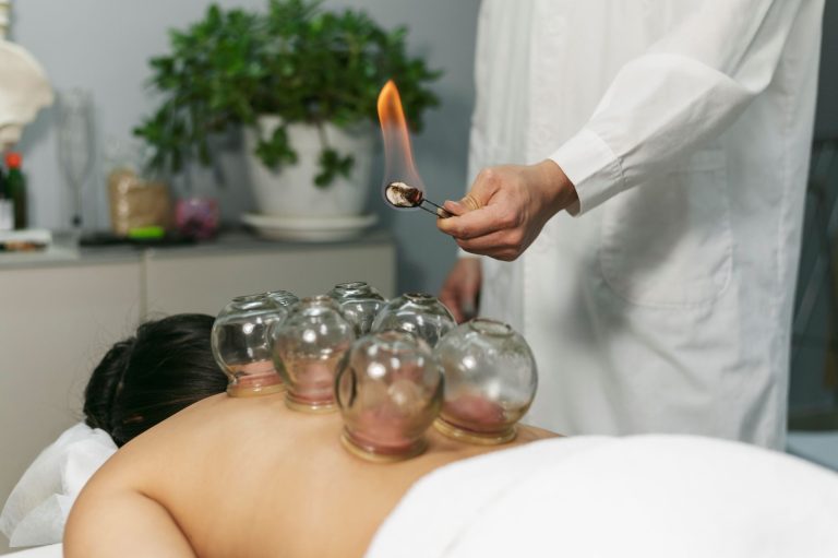 cupping massage