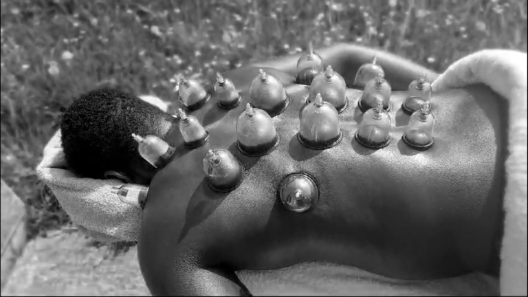 cupping massage massage par ventouses