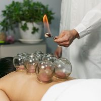 cupping massage